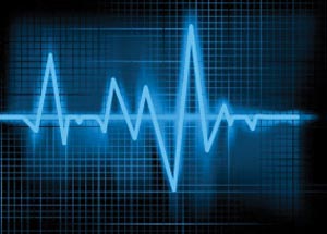 Accessories: Holter LX Analysis Software - Enhanced Plus by Vectracor Qrs Diagnostics  ID 701011-00